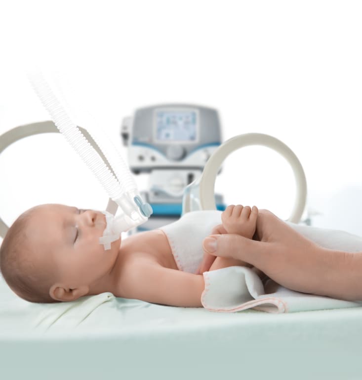 Baby aan een ademnhalingsapparaat