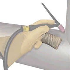 Tig Finger Heat Shield